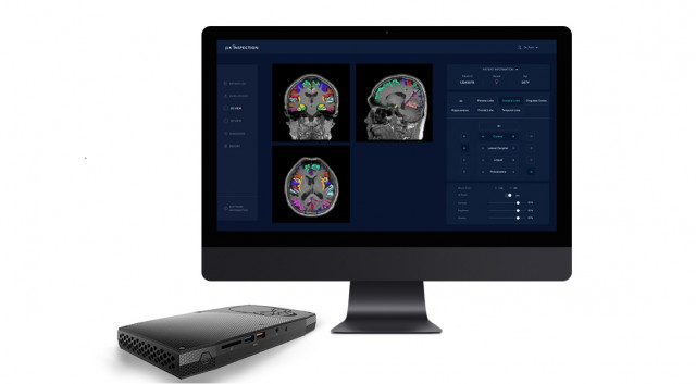 이동성이 높은 미니 PC에 탑재된 제이엘케이 뇌 솔루션