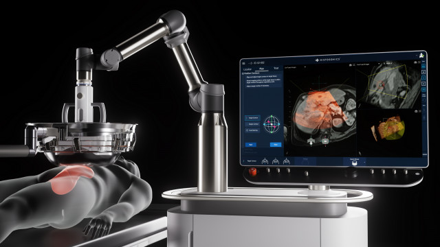 HistoSonics Non-Invasive Edison Histotripsy System