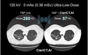 ClariCT.AI 임상 적용 사례(특허기술)