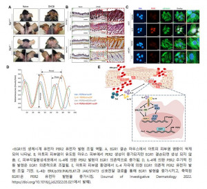 건국대 신순영 교수팀이 ‘아토피 피부염에서 생체리듬 교란’ 원리를 규명했다