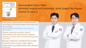 청담해리슨병원의 논문이 JNS Neurosurgical Focus 비디오 저널에 게재됐다