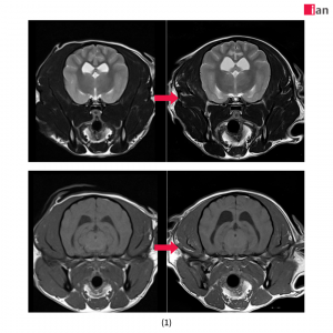 AI 도입 후 품질이 개선된 MRI 영상 사진