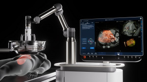 HistoSonics Non-Invasive Edison Histotripsy System
