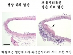 퍼록시리독신 결핍생쥐에서 혈관수술 후 악화된 혈관 사진