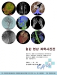 중앙대병원, 혈관영상을 이용한 과학사진전 개최