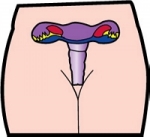 여성 이면 누구나 경험 할 수 있는 질염이란?