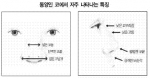동양인 코에서 자주 나타나는 특징