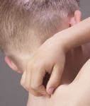 왕따를 부르는 소아 아토피, 체온조절 기능 회복이 관건