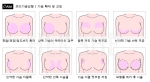 필러로 쁘띠가슴성형 시술이 가능한 부위