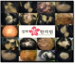탈모치료전문 경희봄한의원, ‘목동점’ 오픈