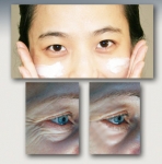 눈가 주름 80%는 자외선으로 인한 피부 손상