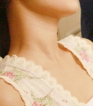 “무리한 다이어트 목주름 유발”