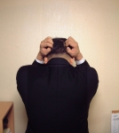 “우수수~ 가을 탈모를 경계하라”