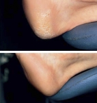 전국기능경기대회 대통령상 빛나는 ‘황미서 GPT 발케어’