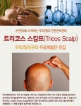 바이리뷰, ‘트리코스 스칼프’ 무료체험단 모집