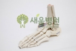 관절 건강 위협하는 잘못된 걷기 운동법