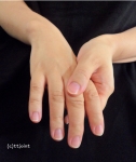손가락도 퇴화…피할 수 없는 퇴행성관절염