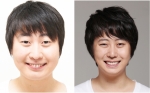 개그맨 조우용, 성형 후 활발한 활동으로 주목