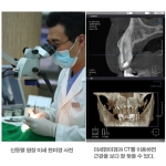 어려운 신경치료, 치과용 미세현미경과 CT로 해결하자