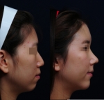 코 모양으로 고급스러운 이미지 변화 가능