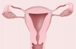 Essure Anatomy