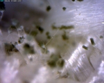 옷에 생긴 곰팡이 현미경 사진