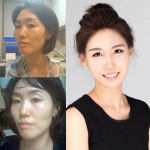 부정교합 노안굴욕녀 김채연, 이수경 도플갱어로 충격 변신해 화제를 모으고 있다,