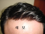이마 부분만 클로즈업한 사진.