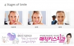 미소를 짓는 4단계에 대해 알아보자.