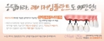 매직키스치과에서 레이저 심미임플란트 이벤트가 진행중이다.