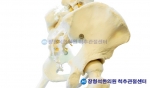 궁둥뼈의 통증은 대부분 좌골신경통으로 발생한다.