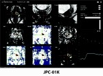 인공지능 기반 전립선 MR 의료영상 분석 솔루션 JPC-01K