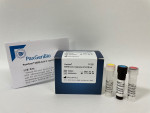 PaxView® SARS-CoV-2 real-time RT-PCR Kit