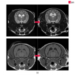 AI 도입 후 품질이 개선된 MRI 영상 사진