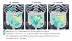 X-ray imaging results of D23 (Budesonide Ileum Targeted Tablet) (Graphic: Business Wire)