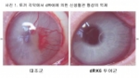 순수 국내 연구진의 기술로 개발 완료된 ‘dRK6(펩타이드)’는 동물(토끼)실험 결과 생체 내에서 신생혈관 발생을 효과적으로 차단하였다