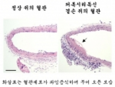퍼록시리독신 결핍생쥐에서 혈관수술 후 악화된 혈관 사진