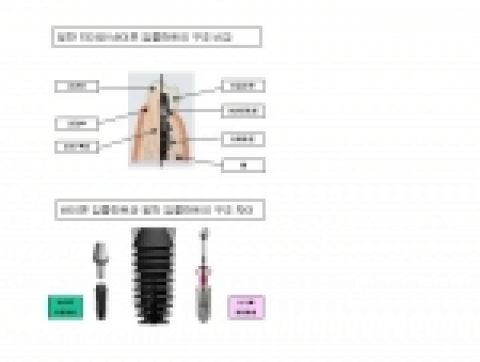 일반 치아와 바이콘 임플란트의 구조 비교 바이콘 임플란트와 일반 임플란트의 구조 차이