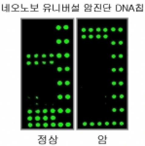 네오노보 암진단 DNA칩. 네오노보의 RNA 발현 여부를 검색함으로써 암세포와 정상세포를 명확하게 구별해내는 네오노보 유니버설 암진단 DNA칩 실험 결과. 초록색 형광 점은 각각 
