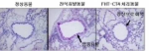 천식에 걸린 동물에 FHT-CT4를 적용한 결과. FHT-CT4를 천식에 걸린 동물의 기도 내 스프레이로 약물을 투약한 후 조직세포를 관찰한 결과 염증부위가 크게 감소했고, 염증세