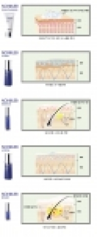 SKIN79 신개념 브랜드 논블렙의 5단계별 여드름 개선 과정