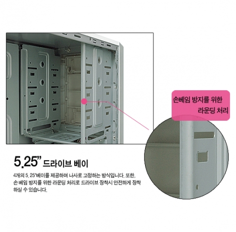 손베임 방치 처리