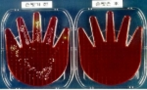 손씻기 전과 후의 MRSA 균 집락 양상. MRSA(Meticilline Resistant Staphyllococcus Areus 의 약자로 티실린 이라는 항생제에 대해 내성을 가