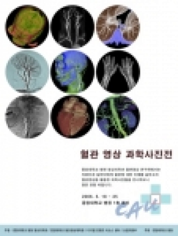 중앙대병원, 혈관영상을 이용한 과학사진전 개최