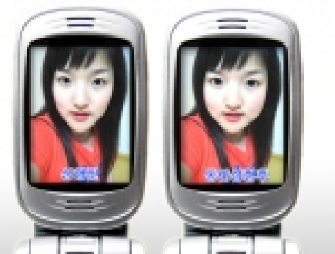 포토스피드성형 동안성형 사용예
