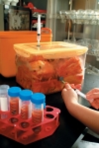 한국식품연구원 전통식품연구본부 이명기 박사팀은 명지대학교 서주원 교수팀과  바이오그린21 지원사업으로 에스아데노실메싸이오닌(S-adenosylmethionine (SAM)) 생성량