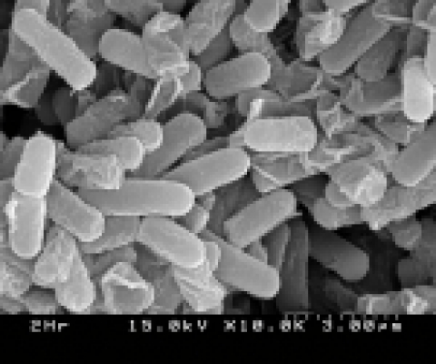 김치유산균(페디오코커스 판토싸세우스) 전자현미경 사진
