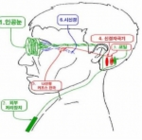 인공시각장치의 개략도
