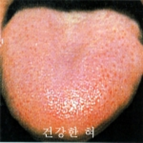 건강한 혀 사진