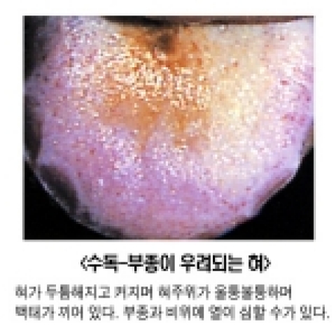 내 몸에 불필요한 독소를 제거하면 건강해진다.